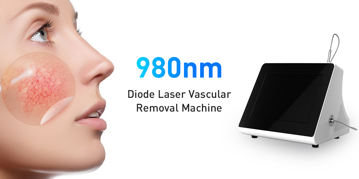 980-nm-Diodenlaser-Gerät zur Entfernung von Besenreisern